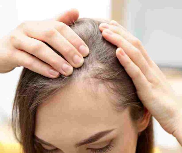 Hair Loss Treatment