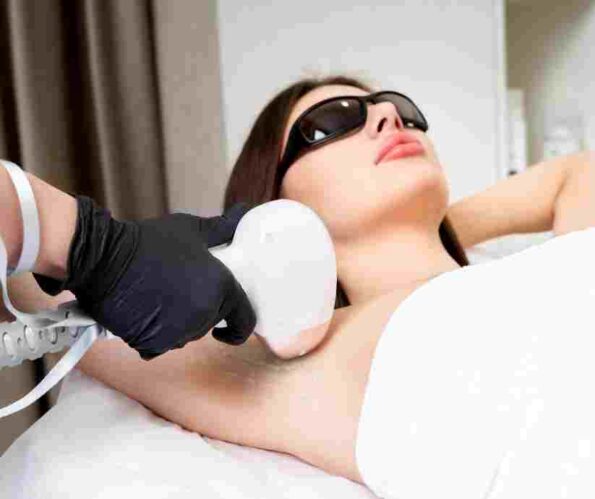 Laser Hair Removal