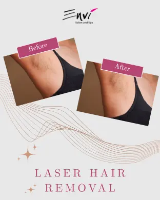 ENVI Laser Hair Removal BEFORE AFTER